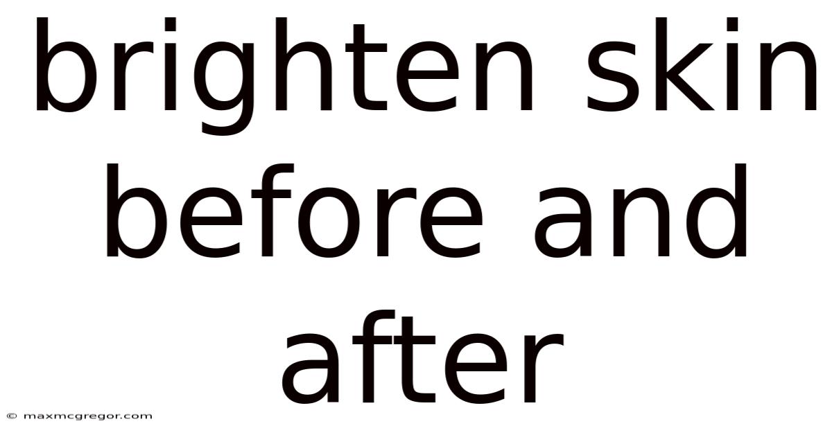 Brighten Skin Before And After