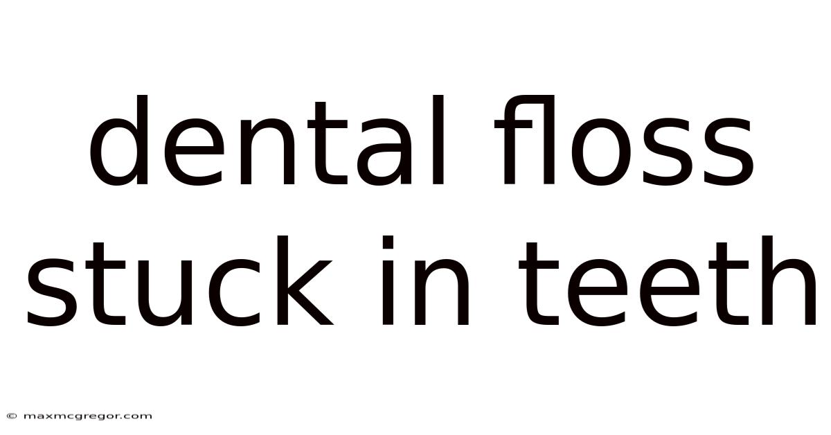 Dental Floss Stuck In Teeth