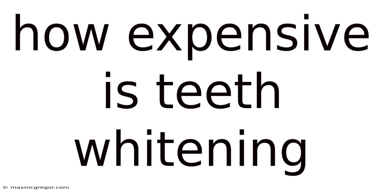 How Expensive Is Teeth Whitening