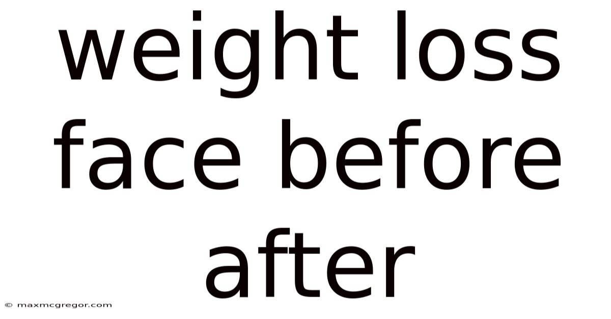 Weight Loss Face Before After